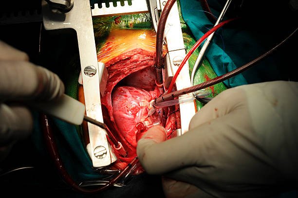 chirurgie cardio-vasculaire clinique mers sultan