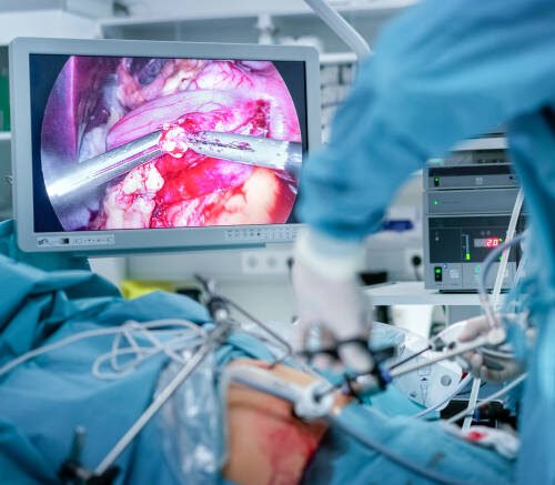 La chirurgie digestive
