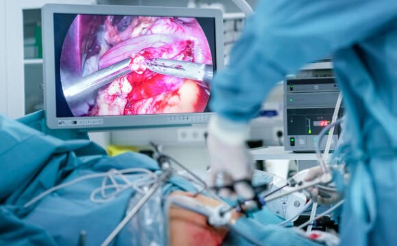 La chirurgie digestive