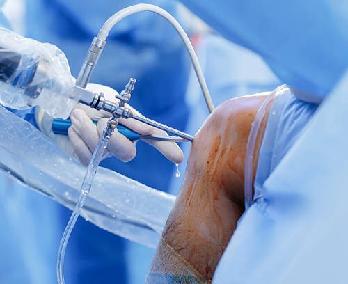 Chirurgie Orthopédique et Traumatologique