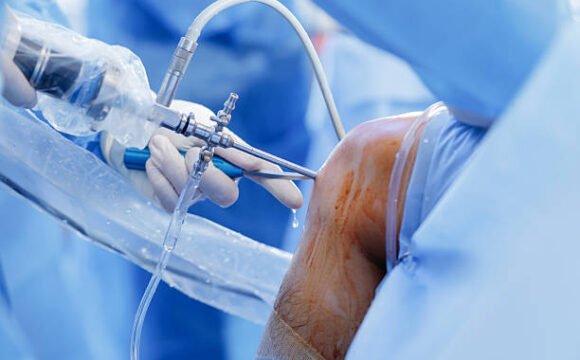Chirurgie Orthopédique et Traumatologique